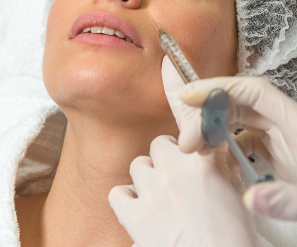Collagen inject-able fillers