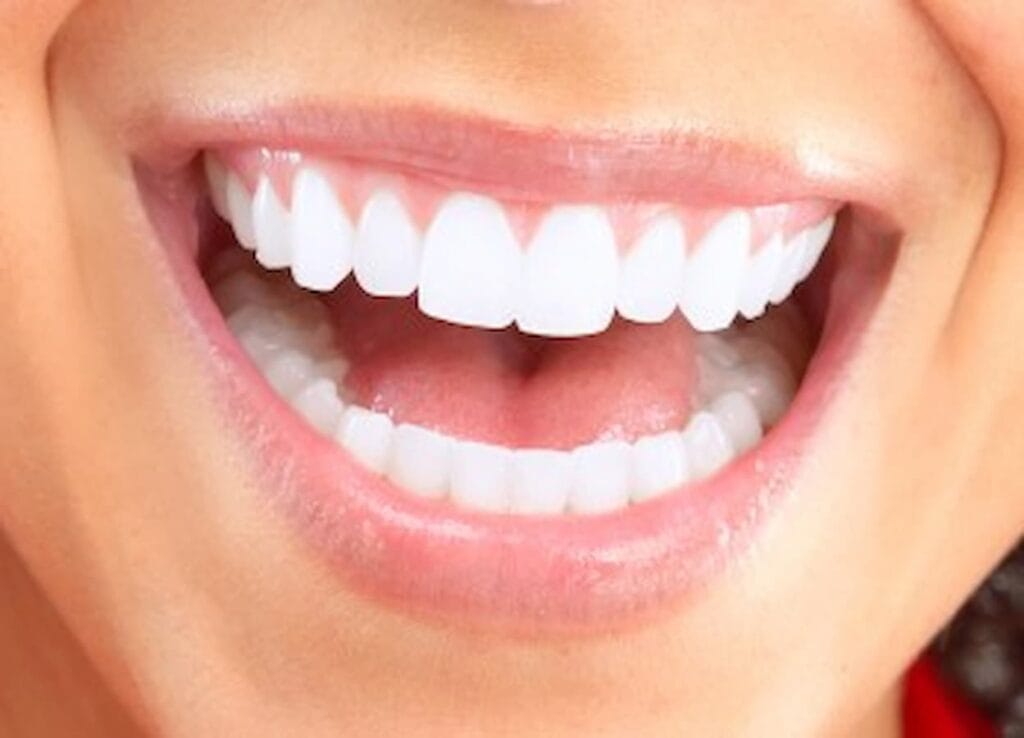 Gingivoplasty