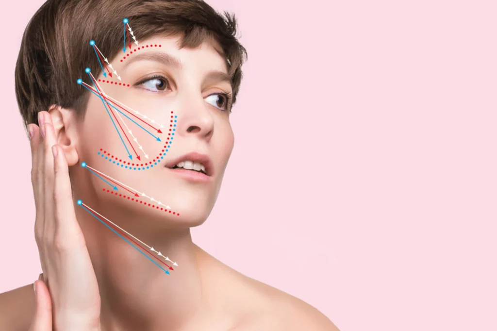 Thread Lift / Facelift