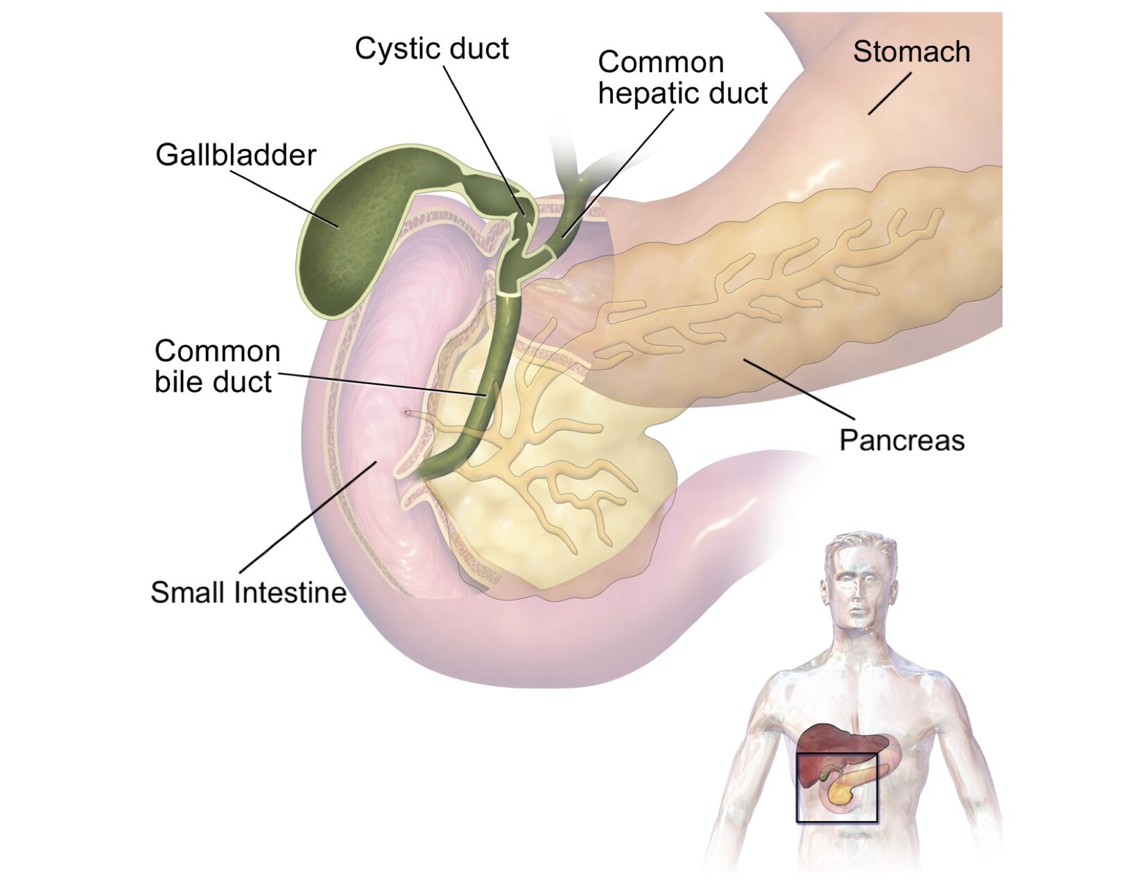 Open Cholecystectomy