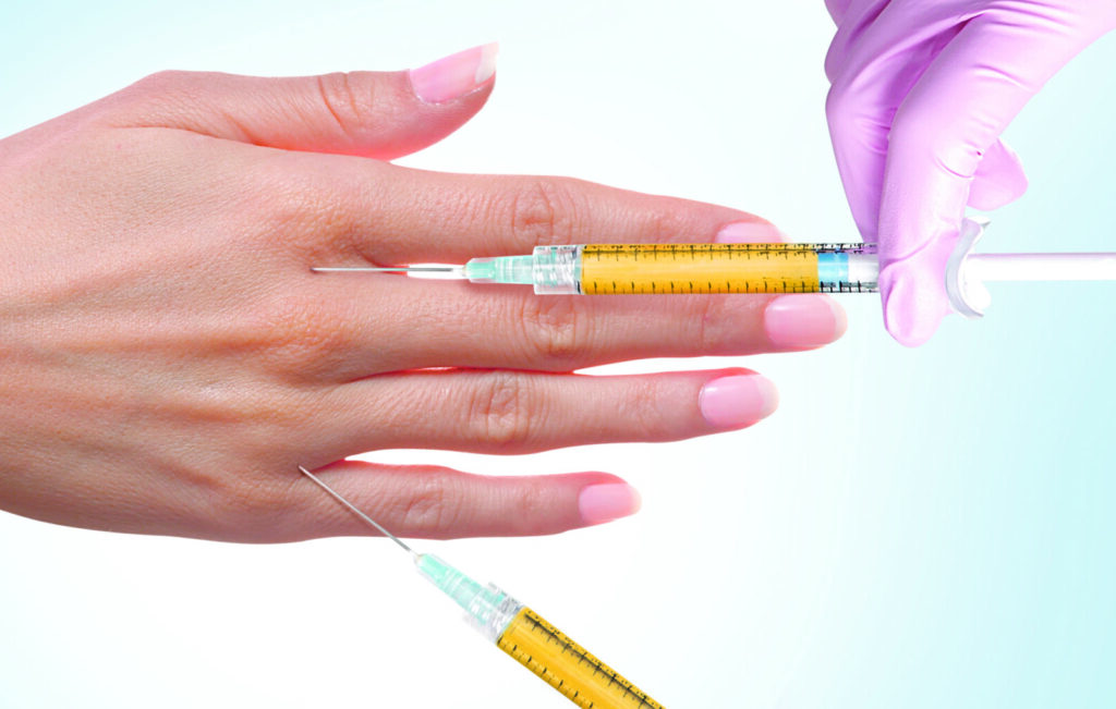 Hand fat injection filler