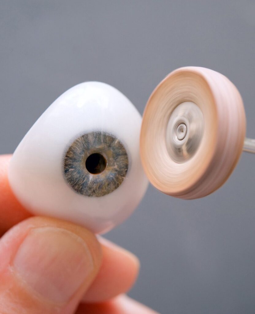 Enucleation Surgery (One Eye)