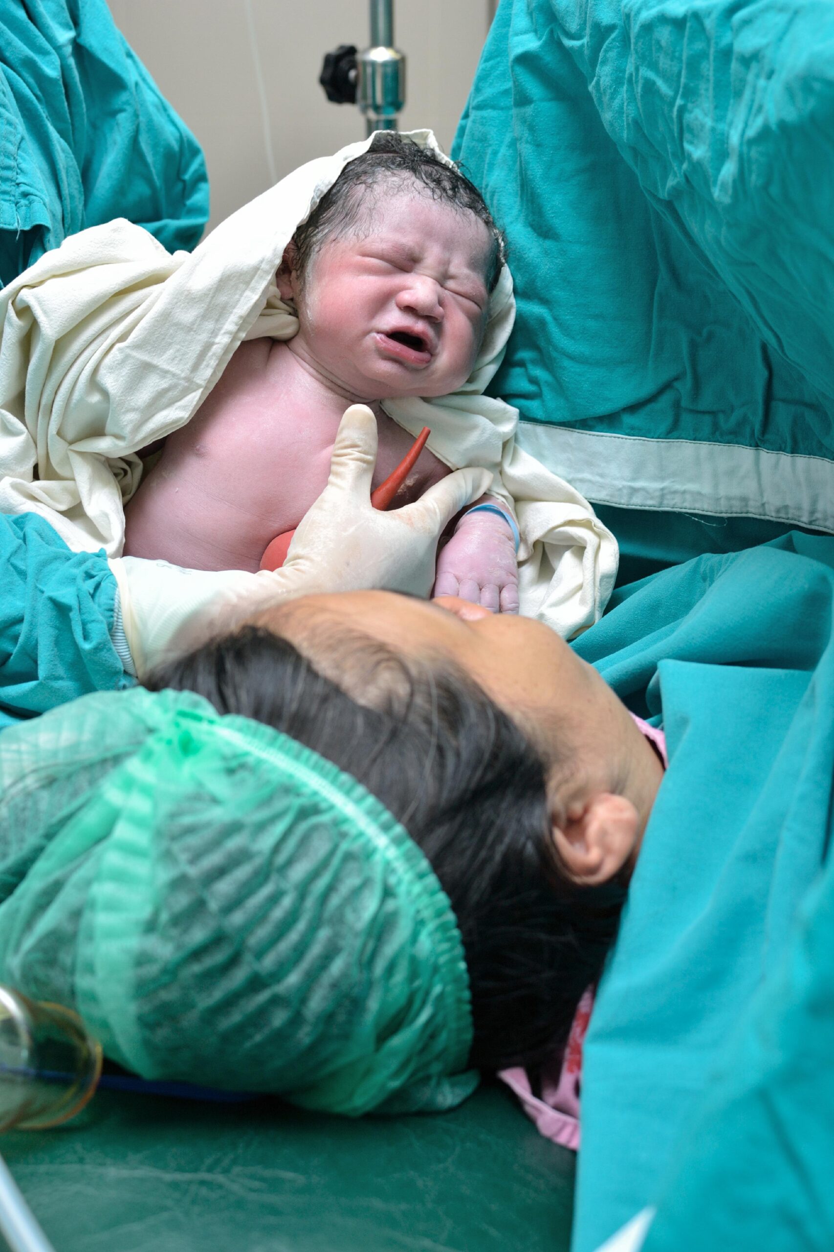 Cesarean delivery