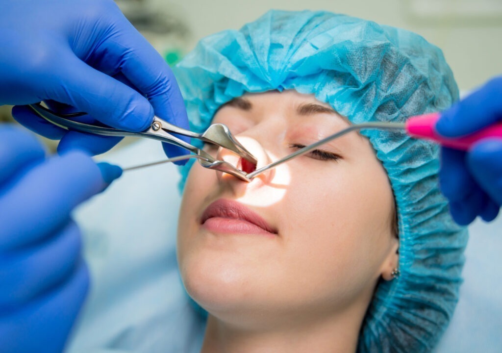 Sinus endoscopy
