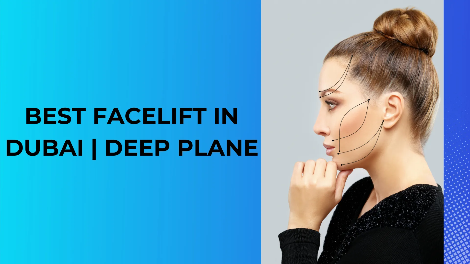 Best Facelift in Dubai | Deep Plane, Mini & Traditional Options