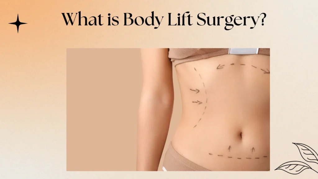 What is Body Lift Surgery?