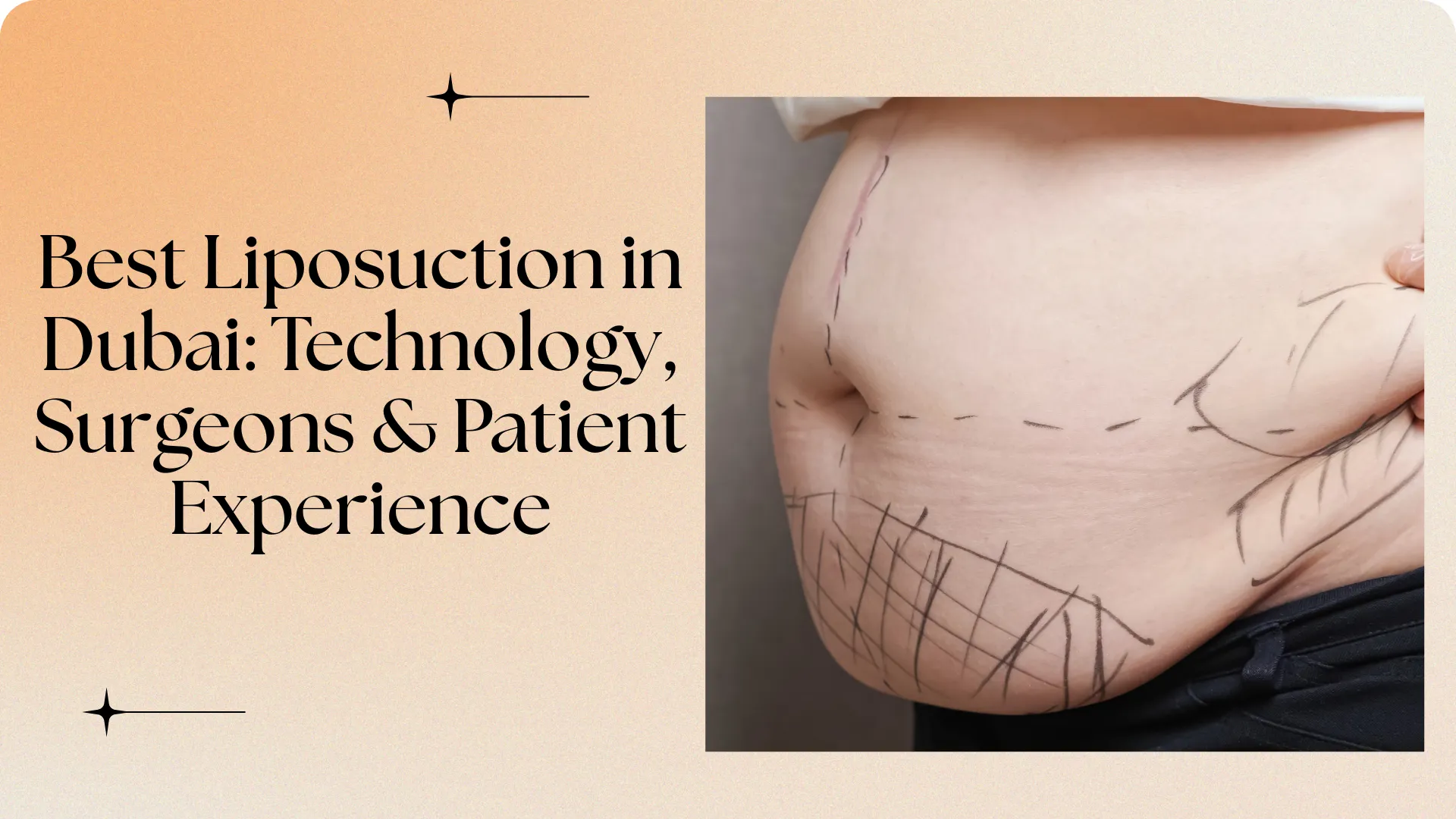 Best Liposuction in Dubai: Technology, Surgeons & Patient Experience