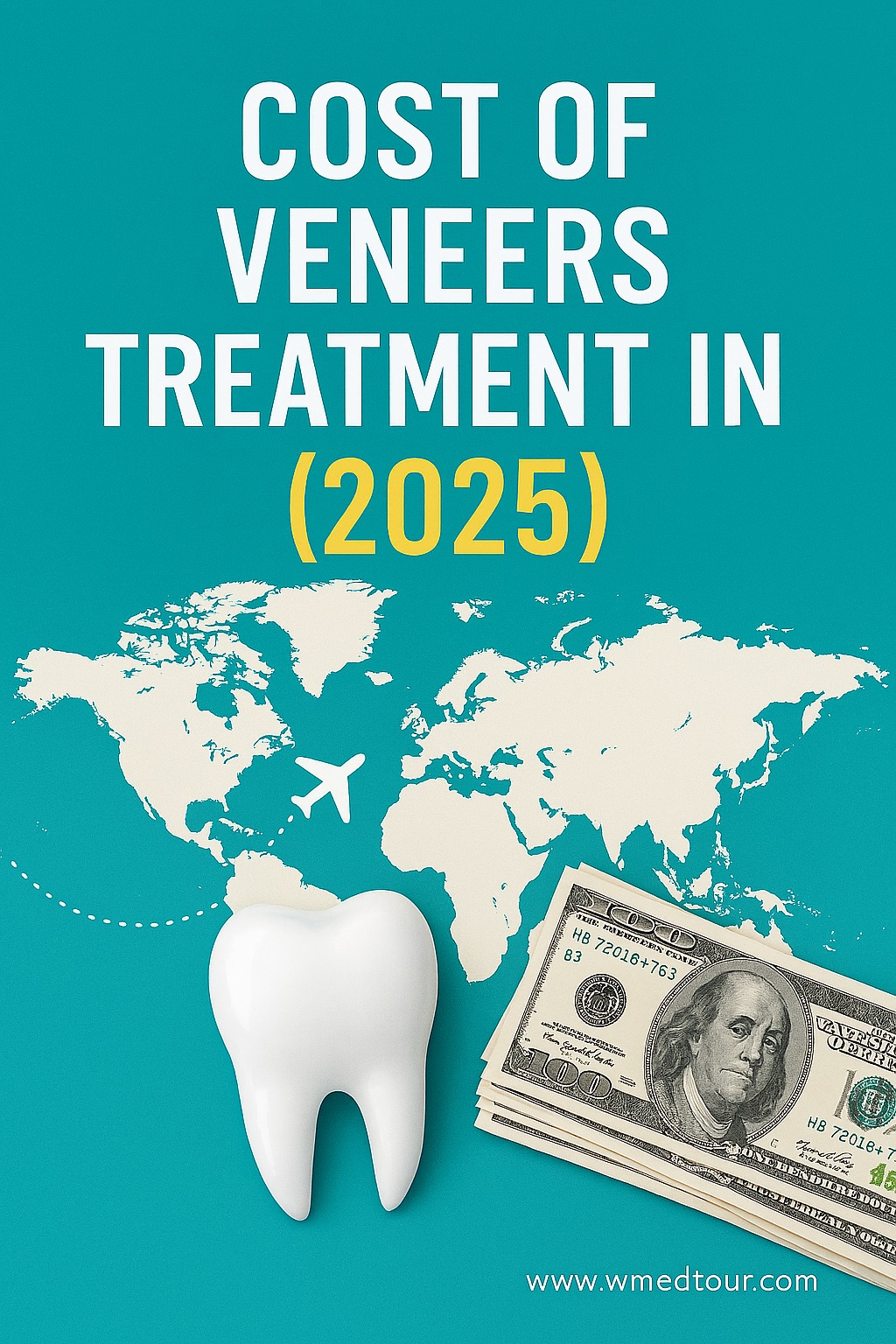 Cost of Veneers Treatment in 2025 – Global Insights