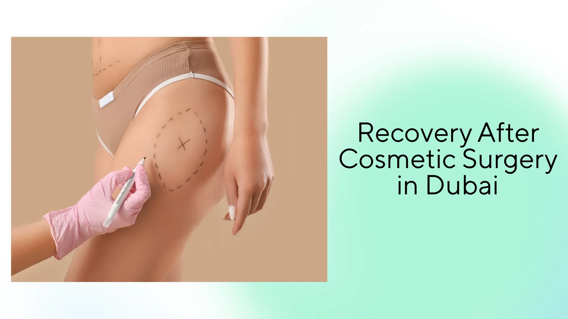 Recovery After Cosmetic Surgery in Dubai