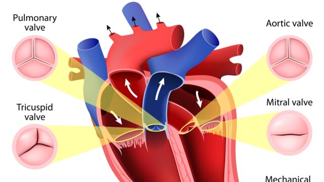 heart valve