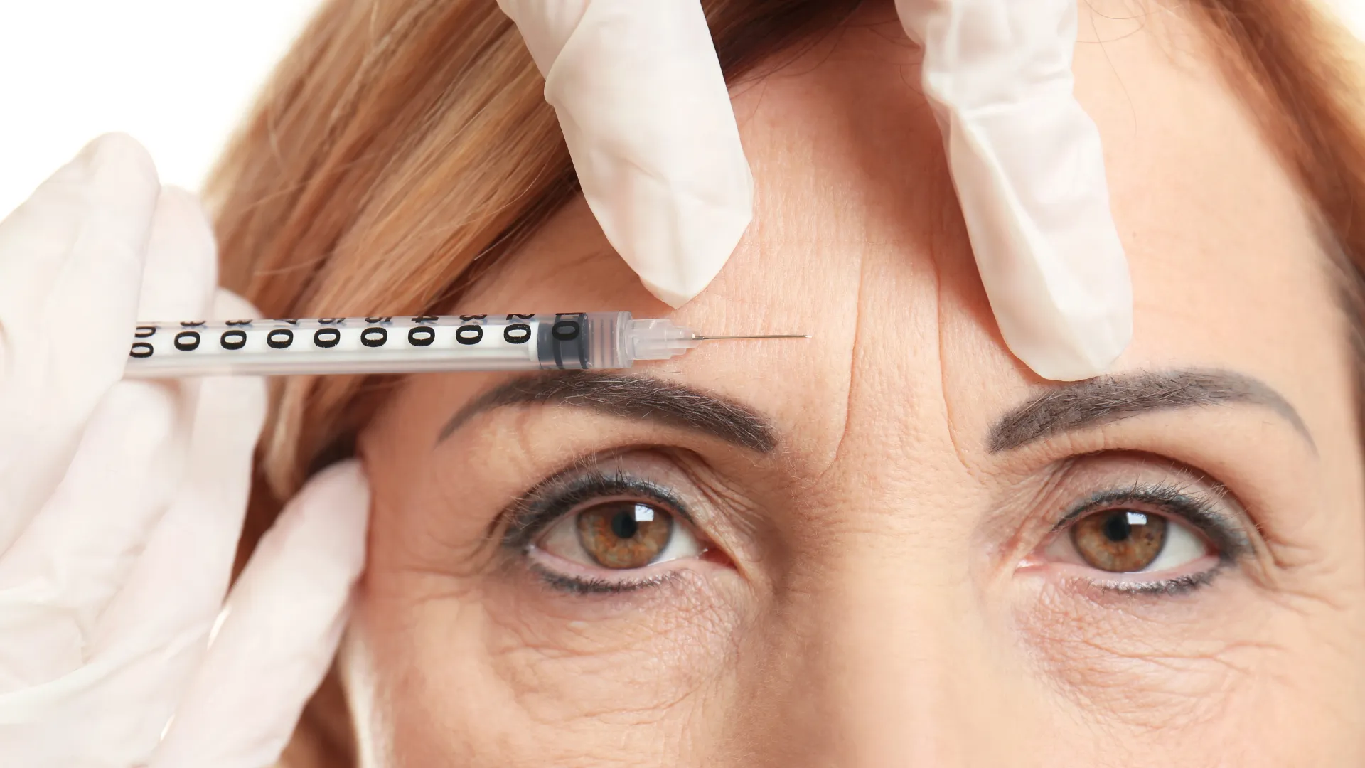 Complete Guide to Botox Injection in Dubai
