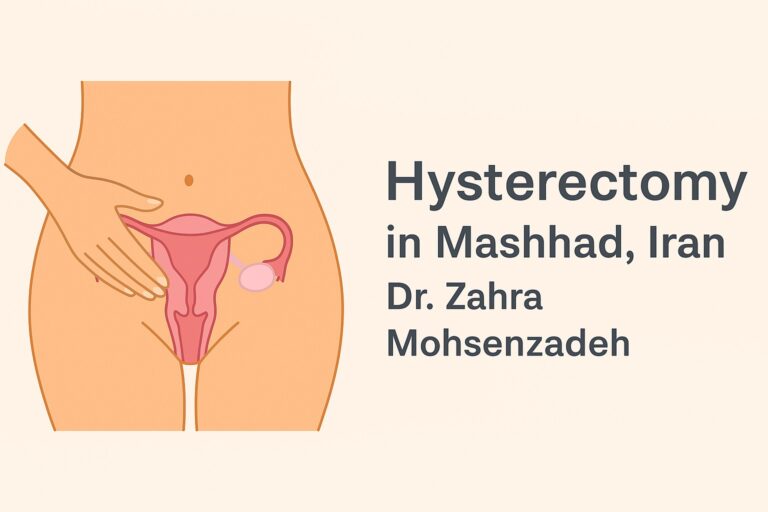 Hysterectomy