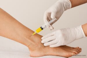 Close-up of PRP injection into patient’s ankle by a medical professional wearing gloves