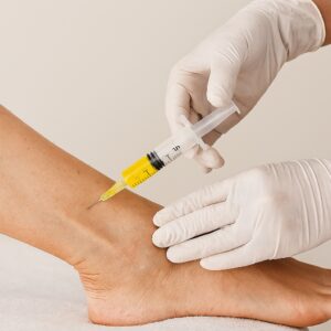 Close-up of PRP injection into patient’s ankle by a medical professional wearing gloves