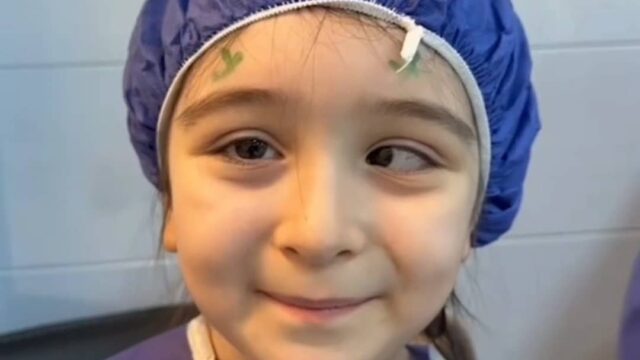 Strabismus (Squint) Correction Surgery