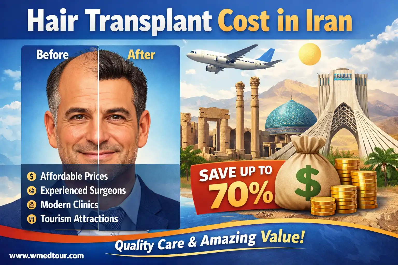 Hair Transplant Cost in Iran